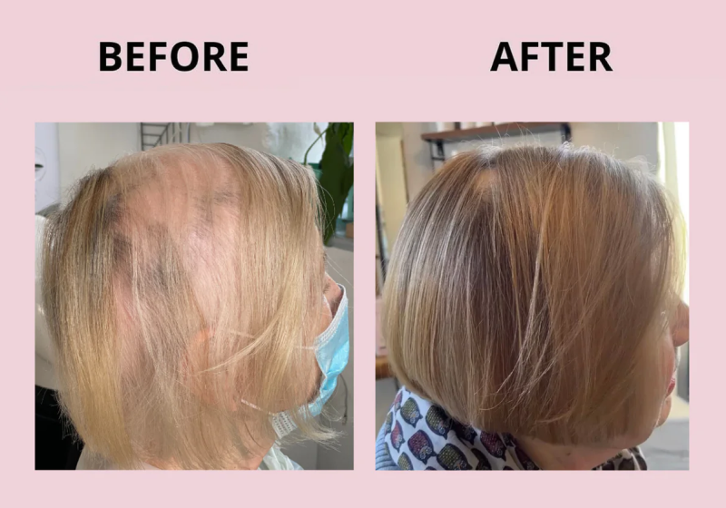 Before After1.png