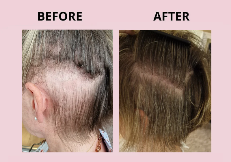Before After2.png